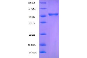 MOMP Protein (AA 24-374) (His-SUMO Tag)