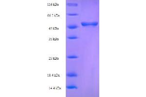 SDS-PAGE (SDS) image for Major Outer Membrane Protein (MOMP) (AA 24-374) protein (His-SUMO Tag) (ABIN5710662) (MOMP Protein (AA 24-374) (His-SUMO Tag))