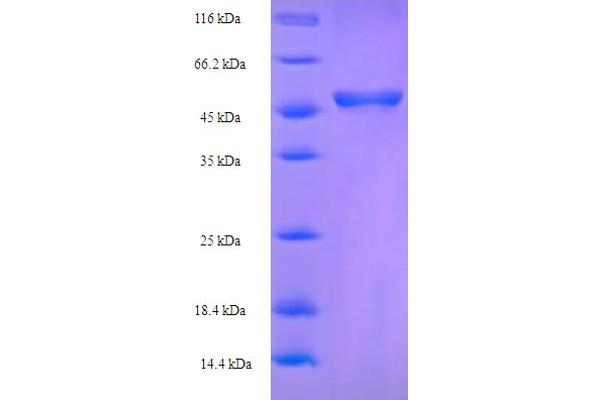MOMP Protein (AA 24-374) (His-SUMO Tag)