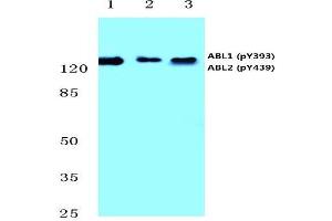 Western Blotting (WB) image for anti-C-Abl Oncogene 1, Non-Receptor tyrosine Kinase (ABL1) (pTyr393), (pTyr439) antibody (ABIN498716)