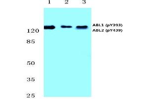 Western blot analysis of p-Abl1/2 antibody (pTyr393/439) Cat. (ABL1 antibody  (pTyr393, pTyr439))