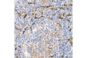 Immunohistochemistry of paraffin-embedded Human tonsil using Fascin/FSCN1 antibody (ABIN7267142) at dilution of 1:100 (40x lens). (Fascin antibody)