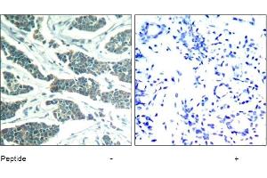 Image no. 1 for anti-V-Akt Murine Thymoma Viral Oncogene Homolog 1 (AKT1) (Tyr312), (Tyr315), (Tyr316) antibody (ABIN319374) (AKT1 antibody  (Tyr312, Tyr315, Tyr316))