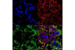 Immunocytochemistry/Immunofluorescence analysis using Mouse Anti-Neuroligin 3 Monoclonal Antibody, Clone S110-29 . (Neuroligin 3 antibody  (AA 730-848) (HRP))