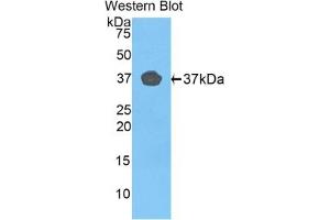 Detection of recombinant FBLN4 using Polyclonal Antibody to Fibulin 4 (FBLN4) (FBLN4 antibody  (AA 278-366))