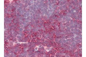 Human Thymus (formalin-fixed, paraffin-embedded) stained with PSENENat 5 µg/ml followed by biotinylated goat anti-rabbit IgG secondary antibody, alkaline phosphatase-streptavidin and chromogen. (PEN2 antibody  (N-Term))
