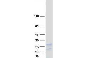 Hepatitis B Virus X-Interacting Protein (HBXIP) protein (Myc-DYKDDDDK Tag)