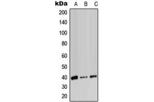 Western blot analysis of ADH7 expression in HeLa (A), SP2/0 (B), PC12 (C) whole cell lysates.