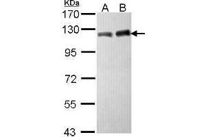 WB Image Sample (30 ug of whole cell lysate) A: Hela B: Hep G2 , 7. (KAP1 antibody  (N-Term))