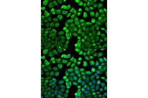 Immunofluorescence analysis of U2OS cell using HNMT antibody. (HNMT antibody  (AA 1-292))