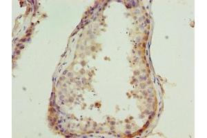 CSAG1 antibody  (AA 20-78)