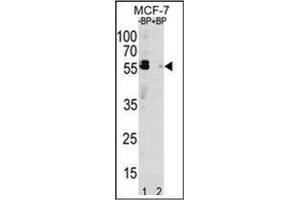 Western blot analysis of SQSTM1 Antibody  pre-incubated without (Lane 1) and with (Lane 2) blocking peptide in MCF-7 cell line lysate. (SQSTM1 antibody  (C-Term))
