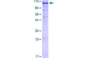 CD51 Protein (AA 1-1048) (GST tag)