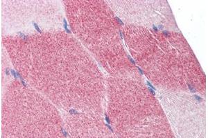Human Skeletal Muscle: Formalin-Fixed, Paraffin-Embedded (FFPE) (EIF4G2 antibody  (AA 1-204))