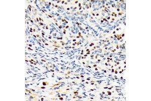 Immunohistochemistry of paraffin-embedded rat ovary using PBRM1 Rabbit mAb (ABIN1512585, ABIN3020942, ABIN3020943 and ABIN7101308) at dilution of 1:100 (40x lens). (Polybromo 1 antibody)