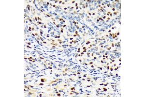 Immunohistochemistry of paraffin-embedded rat ovary using PBRM1 Rabbit mAb (ABIN1512585, ABIN3020942, ABIN3020943 and ABIN7101308) at dilution of 1:100 (40x lens).