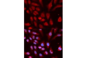 Immunofluorescence analysis of U2OS cells using UHRF1 antibody. (UHRF1 antibody  (AA 1-260))