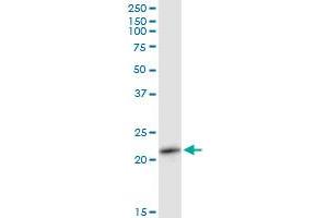 RAB11A MaxPab polyclonal antibody. (RAB11A antibody  (AA 1-216))