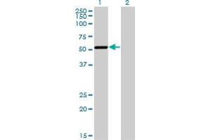 Western Blot analysis of CAMK1G expression in transfected 293T cell line by CAMK1G monoclonal antibody (M01), clone 3E2. (CAMK1G antibody  (AA 1-476))
