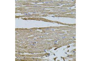 Immunohistochemistry of paraffin-embedded rat heart using HMMR antibody (ABIN5971368) at dilution of 1/100 (40x lens). (HMMR antibody)