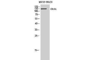 Western Blotting (WB) image for anti-CD101 (CD101) (Internal Region) antibody (ABIN3178946) (CD101 antibody  (Internal Region))