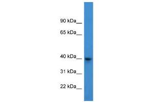 WB Suggested Anti-ARPM1 Antibody Titration: 0. (ARPM1 antibody  (N-Term))