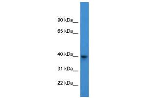 WB Suggested Anti-ARPM1 Antibody Titration: 0. (ARPM1 antibody  (N-Term))