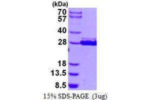 HscB Iron-Sulfur Cluster Co-Chaperone Homolog (HSCB) protein (His tag)