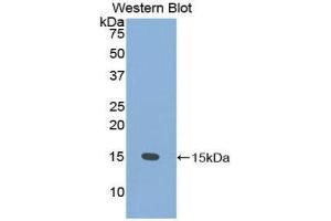 Western Blotting (WB) image for anti-Prostate Stem Cell Antigen (PSCA) (AA 22-95) antibody (ABIN1860333) (PSCA antibody  (AA 22-95))