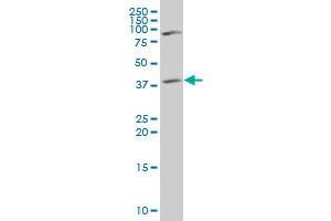 ST3GAL4 polyclonal antibody (A01), Lot # 051207JC01. (ST3GAL4 antibody  (AA 31-130))