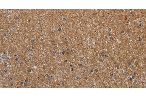 Immunohistochemistry of paraffin-embedded Human brain tissue using NAA25 Polyclonal Antibody at dilution 1:40