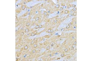 Immunohistochemistry of paraffin-embedded mouse brain using HSP90 antibody (ABIN6134707, ABIN6142027, ABIN6142029 and ABIN6216078) at dilution of 1:200 (40x lens). (HSP90AA1 antibody)