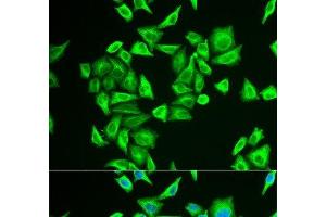 Immunofluorescence analysis of U2OS cells using PGM1 Polyclonal Antibody (Phosphoglucomutase 1 antibody)