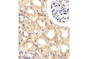 Immunohistochemical analysis of paraffin-embedded H. (UBE2L3 antibody  (C-Term))