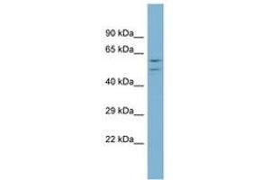 Image no. 1 for anti-ATPase, H+ Transporting, Lysosomal 56/58kDa, V1 Subunit B1 (ATP6V1B1) (AA 395-444) antibody (ABIN6744044) (ATP6V1B1 antibody  (AA 395-444))