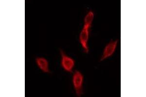 ABIN6276046 staining MCF7 by IF/ICC. (MC4R antibody  (C-Term))