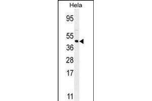 FOXL2 antibody  (N-Term)