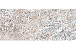 Immunohistochemistry of paraffin-embedded Human tonsil tissue using CTRB1 Polyclonal Antibody at dilution of 1:55(x200) (CTRB1 antibody)