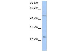 TMCO1 antibody used at 1 ug/ml to detect target protein. (TMCO1 antibody  (C-Term))