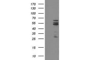 HEK293T cells were transfected with the pCMV6-ENTRY control (Left lane) or pCMV6-ENTRY CYP2C9 (Right lane) cDNA for 48 hrs and lysed. (CYP2C9 antibody)