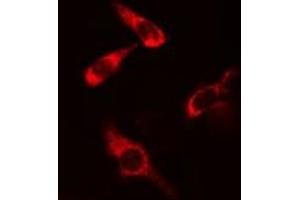 ABIN6277817 staining COLO205 cells by IF/ICC. (CARD11 antibody  (Internal Region))