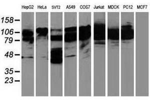 Image no. 3 for anti-Breast Cancer Anti-Estrogen Resistance 1 (BCAR1) antibody (ABIN1496834) (BCAR1 antibody)