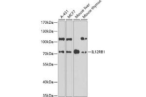 Western blot analysis of extracts of various cell lines, using IL12RB1 antibody (ABIN6132305, ABIN6142300, ABIN6142302 and ABIN6219020) at 1:1000 dilution. (IL12RB1 antibody  (AA 25-305))