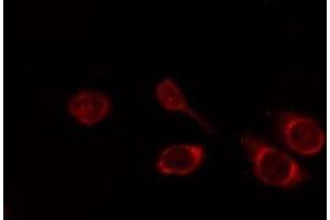 ABIN6268769 staining HuvEc by IF/ICC. (CD147 antibody  (C-Term))