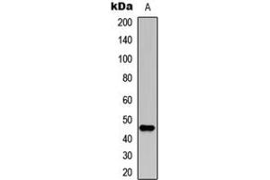Western blot analysis of p47 phox (pS304) expression in A549 UV-treated (A) whole cell lysates. (NCF1 antibody  (C-Term, pSer304))