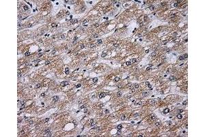 Immunohistochemical staining of paraffin-embedded liver tissue using anti-BTK mouse monoclonal antibody. (BTK antibody)