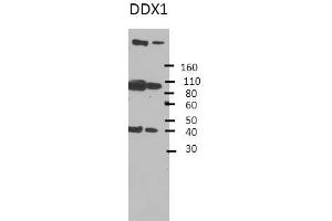 DDX1 antibody - middle region  validated by WB using Hek 293 Whole Cell Lysate at 1:4,000.