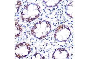 Immunohistochemistry of paraffin-embedded rat testis using Serotonin transporter Rabbit pAb (ABIN7270477) at dilution of 1:100 (40x lens). (SLC6A4 antibody  (C-Term))