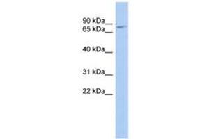Image no. 1 for anti-Zinc Finger and BTB Domain Containing 20 (ZBTB20) (AA 395-444) antibody (ABIN6742288) (ZBTB20 antibody  (AA 395-444))