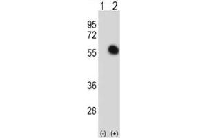 Western blot analysis of GATA2 antibody and 293 cell lysate either nontransfected (Lane 1) or transiently transfected (2) with the GATA2 gene.